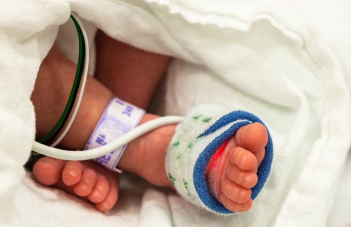 Baby's Feet In Neonatal Care Unit